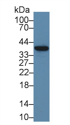 Polyclonal Antibody to NADH Dehydrogenase 1 (ND1)