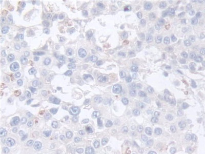 Polyclonal Antibody to Adipocyte Plasma Membrane Associated Protein (APMAP)