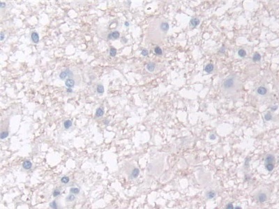 Polyclonal Antibody to Adipocyte Plasma Membrane Associated Protein (APMAP)