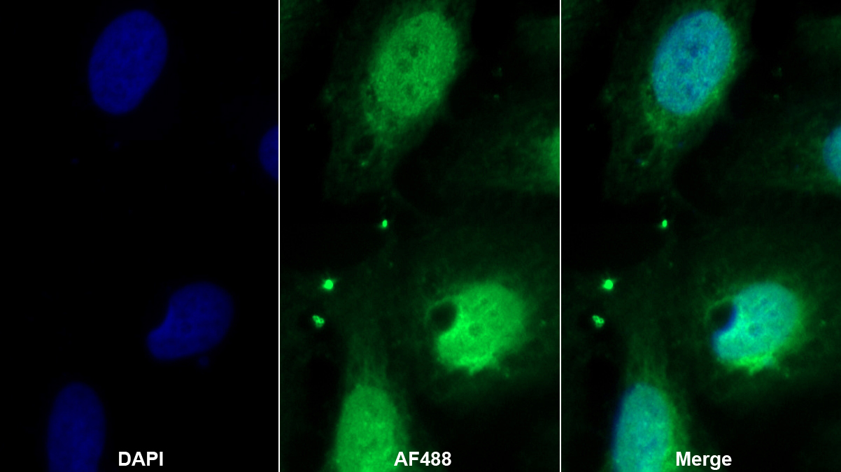 Polyclonal Antibody to Poly A Binding Protein Cytoplasmic 1 Like Protein (PABPC1L)