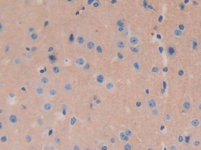 Polyclonal Antibody to G Protein Gamma 8 (GNg8)