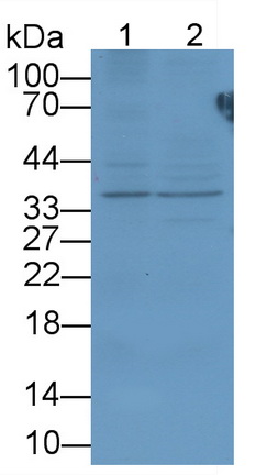 Polyclonal Antibody to Peptidase Inhibitor 16 (PI16)