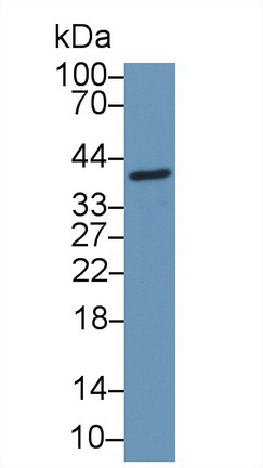 Polyclonal Antibody to Coiled Coil Domain Containing Protein 3 (CCDC3)