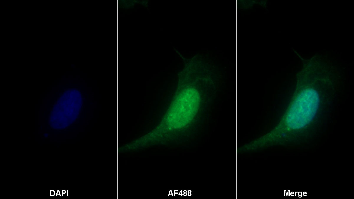 Polyclonal Antibody to C2 Calcium Dependent Domain Containing Protein 3 (C2CD3)