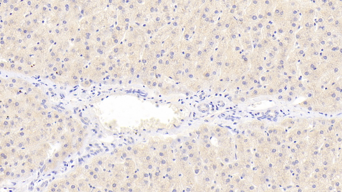 Polyclonal Antibody to Coenzyme Q10 Homolog B (COQ10B)