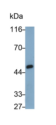 Polyclonal Antibody to Ly1 Antibody Reactive Homolog (LYAR)