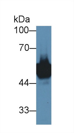 Polyclonal Antibody to Ly1 Antibody Reactive Homolog (LYAR)