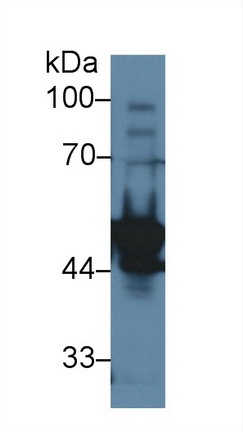 Polyclonal Antibody to Ly1 Antibody Reactive Homolog (LYAR)