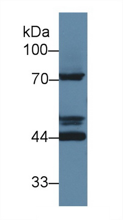 Polyclonal Antibody to Ly1 Antibody Reactive Homolog (LYAR)