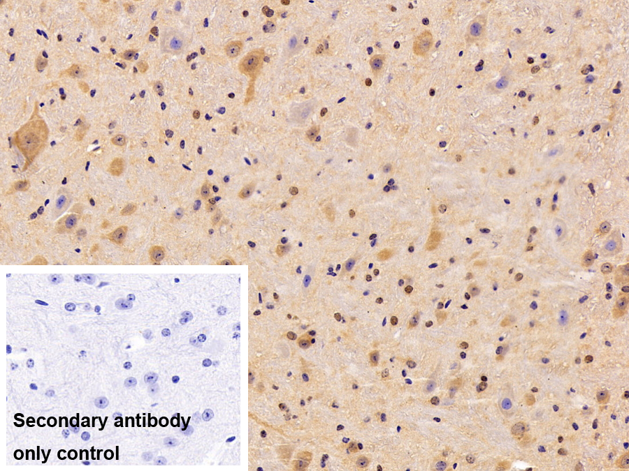 Polyclonal Antibody to Spindlin 3 (SPIN3)