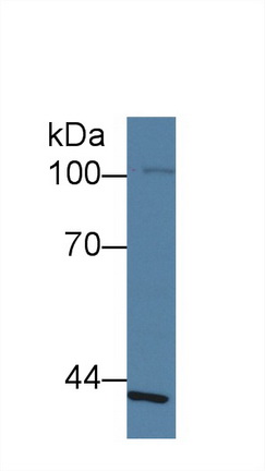 Polyclonal Antibody to Schlafen Family Member 5 (SLFN5)