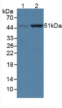 Polyclonal Antibody to Coenzyme Q6 Homolog, Monooxygenase (COQ6)