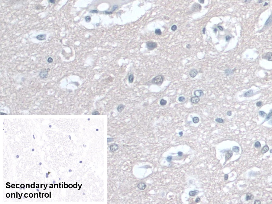 Polyclonal Antibody to Coenzyme Q6 Homolog, Monooxygenase (COQ6)