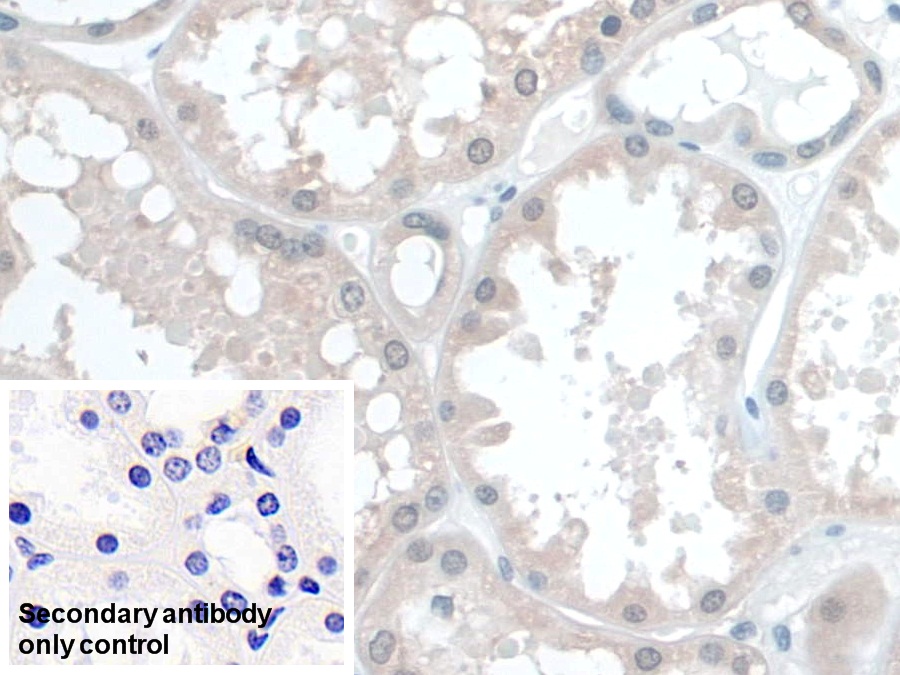 Polyclonal Antibody to Coenzyme Q6 Homolog, Monooxygenase (COQ6)