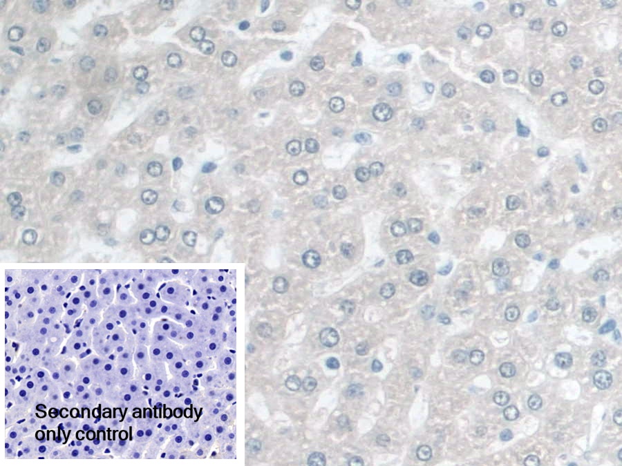 Polyclonal Antibody to Coenzyme Q6 Homolog, Monooxygenase (COQ6)