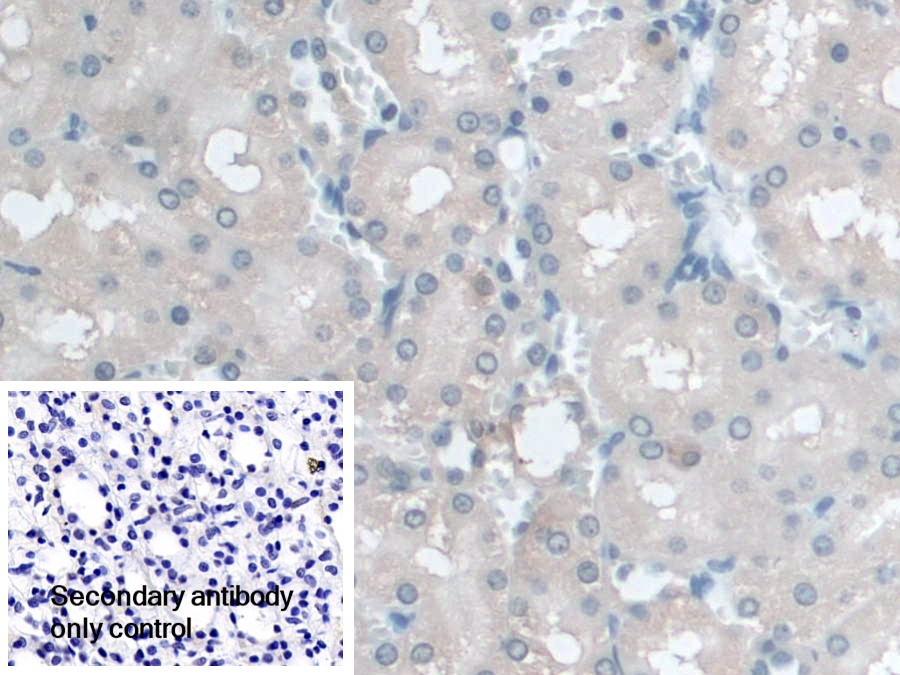 Polyclonal Antibody to Coenzyme Q6 Homolog, Monooxygenase (COQ6)