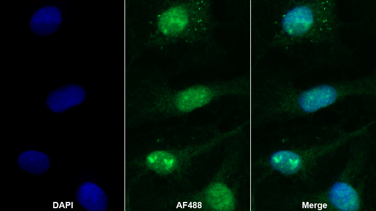 Polyclonal Antibody to RAD54 Like Protein 2 (RAD54L2)