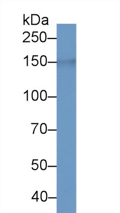 Polyclonal Antibody to LIM And Calponin Homology Domains Containing Protein 1 (LIMCH1)