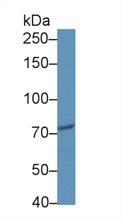 Polyclonal Antibody to Cancerous Inhibitor Of PP2A (CIP2A)