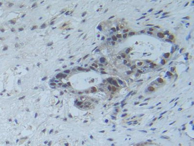 Polyclonal Antibody to Raft Linking Protein (Raftlin)