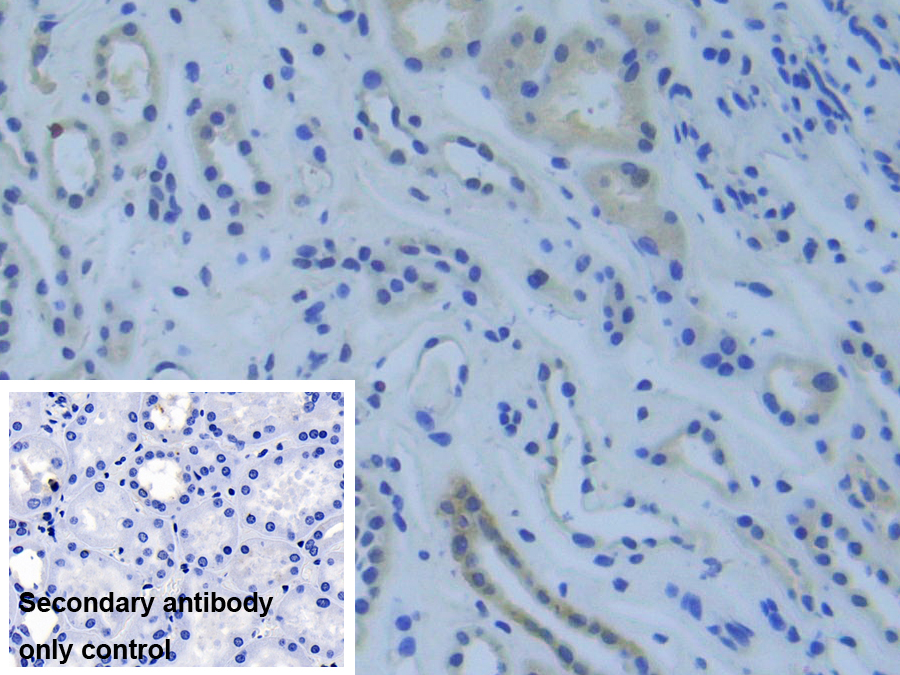 Polyclonal Antibody to Raft Linking Protein (Raftlin)