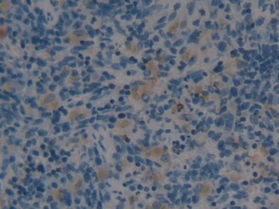 Polyclonal Antibody to Angiotensin 1-7 (Ang1-7)