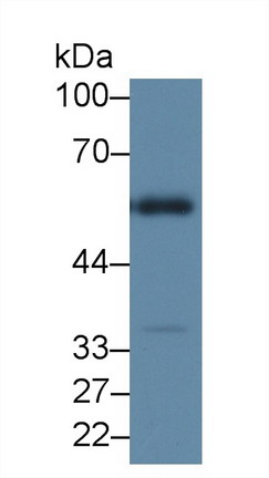 Polyclonal Antibody to Hyaluronoglucosaminidase 1 (HYAL1)