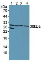 Polyclonal Antibody to Notch2 N-Terminal Like Protein (NOTCH2NL)