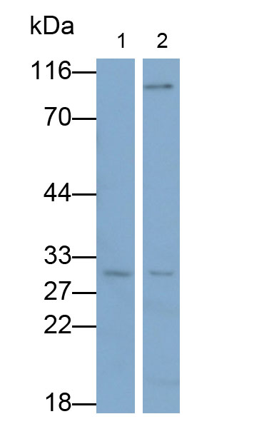 Polyclonal Antibody to Notch2 N-Terminal Like Protein (NOTCH2NL)