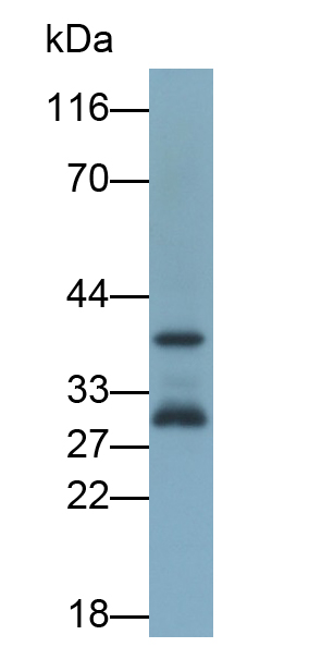 Polyclonal Antibody to Folate Receptor 4 (FOLR4)