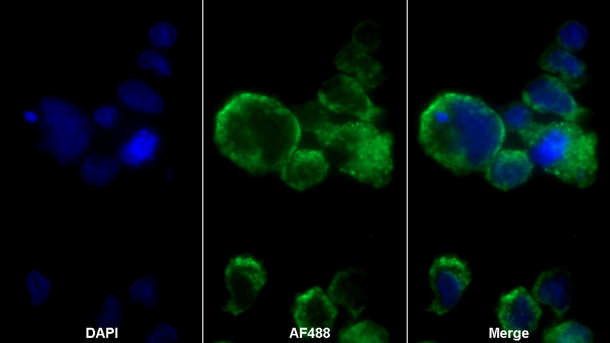 Polyclonal Antibody to Sialic Acid Binding Ig Like Lectin 14 (SIGLEC14)