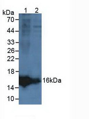 Polyclonal Antibody to Lipocalin Like Protein 1 (LCNL1)