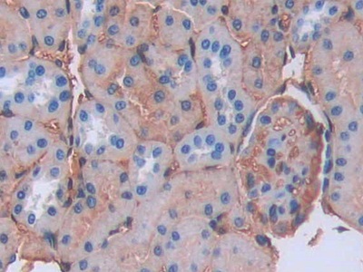 Polyclonal Antibody to Lipocalin Like Protein 1 (LCNL1)