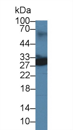 Polyclonal Antibody to Ubiquitin Carboxyl Terminal Hydrolase L4 (UCHL4)