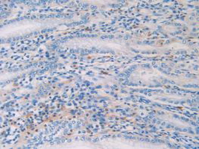 Polyclonal Antibody to Histone Cluster 1, H2ag (HIST1H2AG)