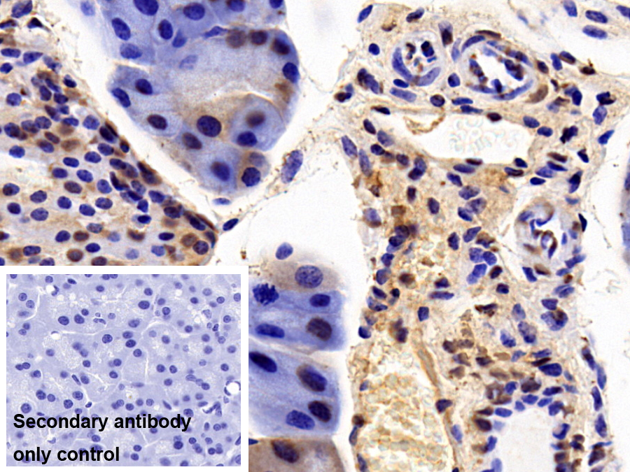 Polyclonal Antibody to H2A Histone Family, Member J (H2AFJ)