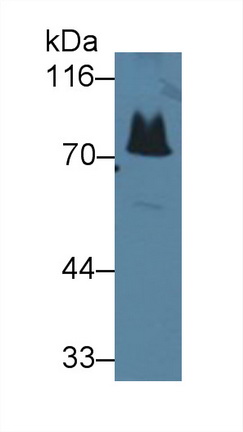 Polyclonal Antibody to NADH Dehydrogenase 5 (ND5)