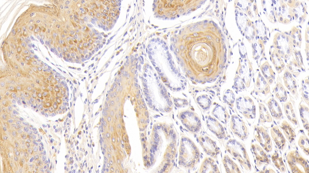 Polyclonal Antibody to Mab21 Domain Containing Protein 1 (MB21D1)