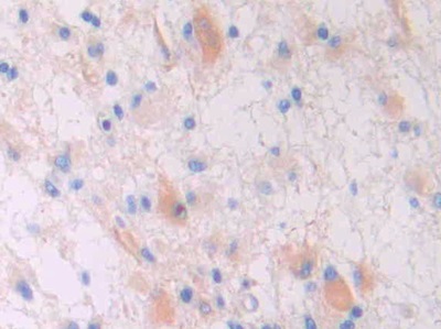 Polyclonal Antibody to Galectin 9B (GAL9B)