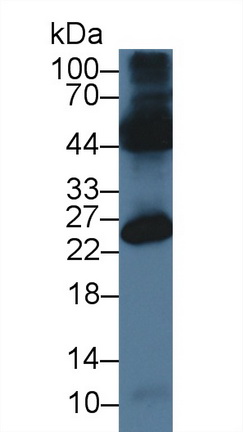 Polyclonal Antibody to Occludin/ELL Domain Containing Protein 1 (OCEL1)