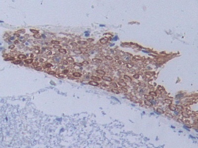 Polyclonal Antibody to Methyltransferase Like Protein 21C (METTL21C)