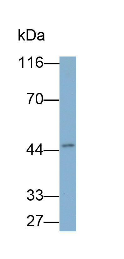 Polyclonal Antibody to Galectin 9C (GAL9C)