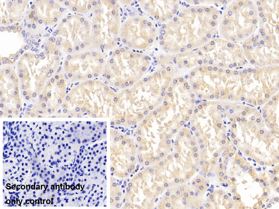 Polyclonal Antibody to Galectin 9C (GAL9C)