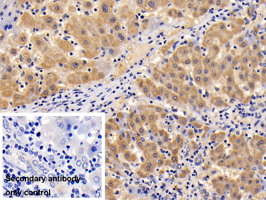 Polyclonal Antibody to Galectin 9C (GAL9C)