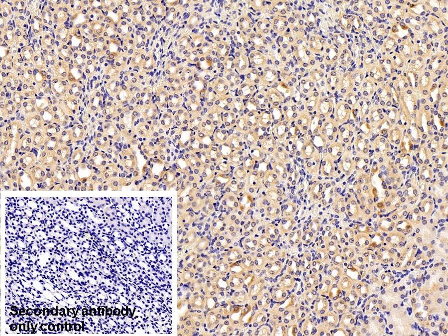 Polyclonal Antibody to Complement Component 3c (C3c)