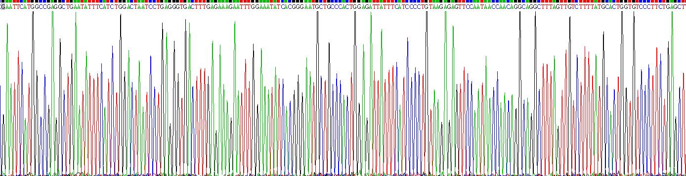 Recombinant Interleukin 8 Receptor Alpha (IL8Ra)