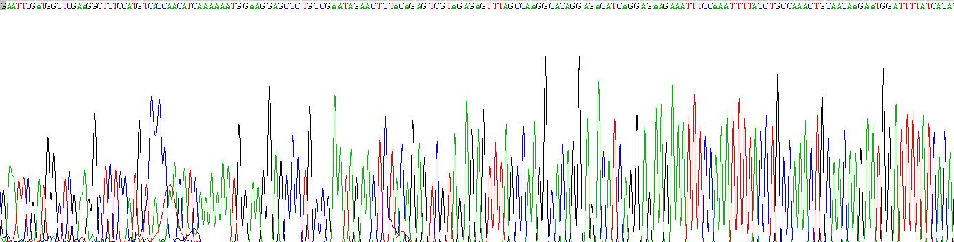 Recombinant Insulin Like Growth Factor Binding Protein 1 (IGFBP1)