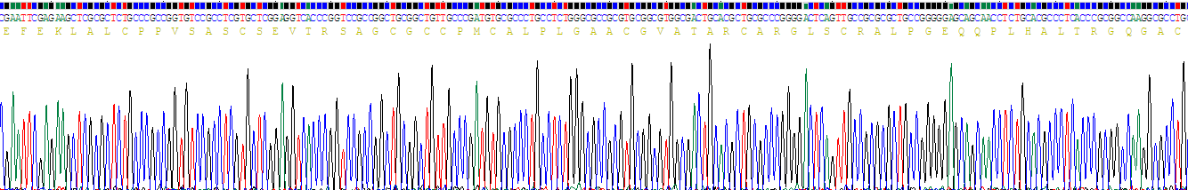 Recombinant Insulin Like Growth Factor Binding Protein 1 (IGFBP1)