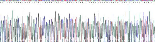 Recombinant Insulin Like Growth Factor Binding Protein 3 (IGFBP3)