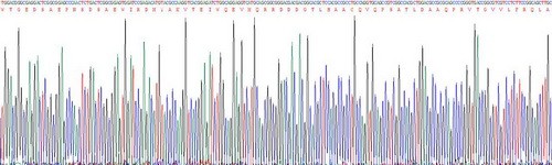 Recombinant Superoxide Dismutase 3, Extracellular (SOD3)